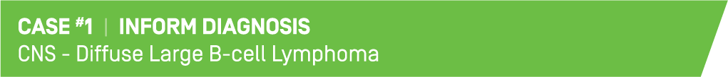This is image which reads "Case #1 | Inform Diagnosis,
CNS - Diffuse Large B-cell Lymphoma"