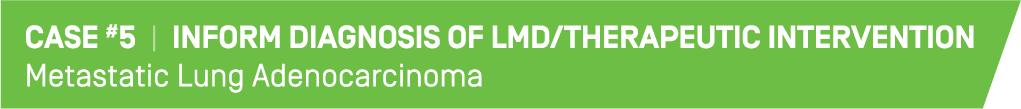 This is an image which reads "Case #5 | Inform Diagnosis of LMD/Therapeutic Intervention
Metastatic Lung Adenocarcinoma"